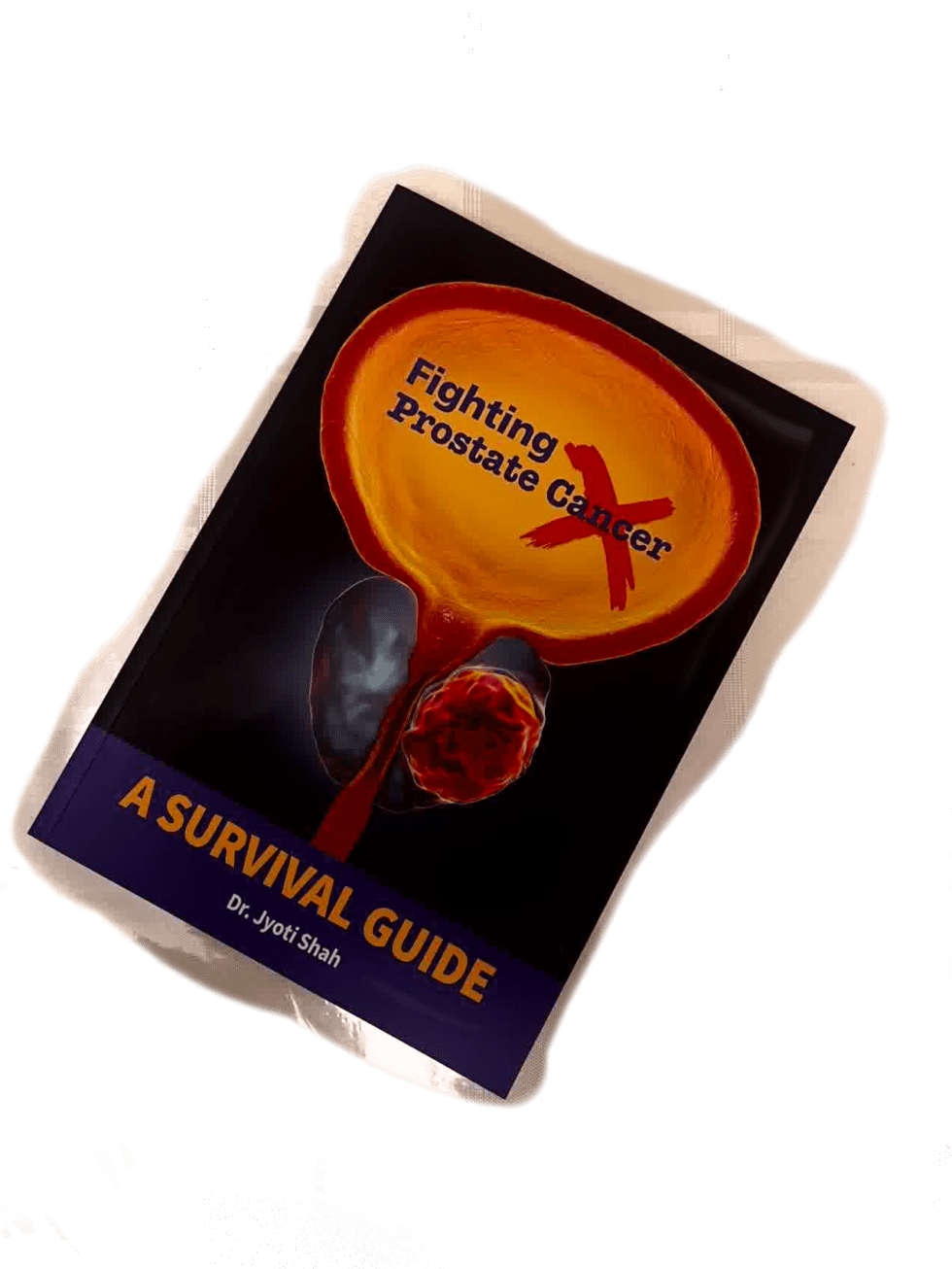 Fighting Prostate Cancer A Survival Guide Jyoti Shah